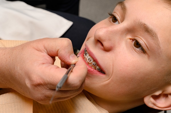 A Pediatric Dentist Could be a Great Choice for Your Child’s Dental Care