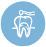 Root Canal Treatment Somerville