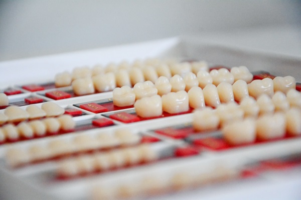 Which Tooth Crowns Are Best