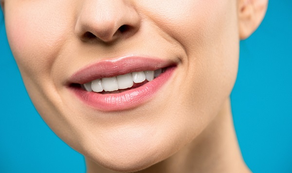 What are Teeth Whitening Services