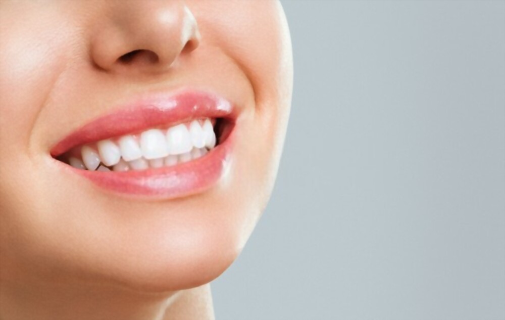 What are Teeth Whitening Services?