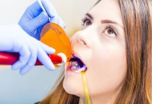 Dental Bonding Medford