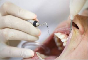 Periodontal Therapy Somerville & Medford, MA