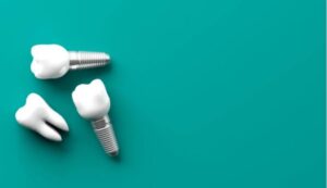 Dental Implants Somerville & Medford
