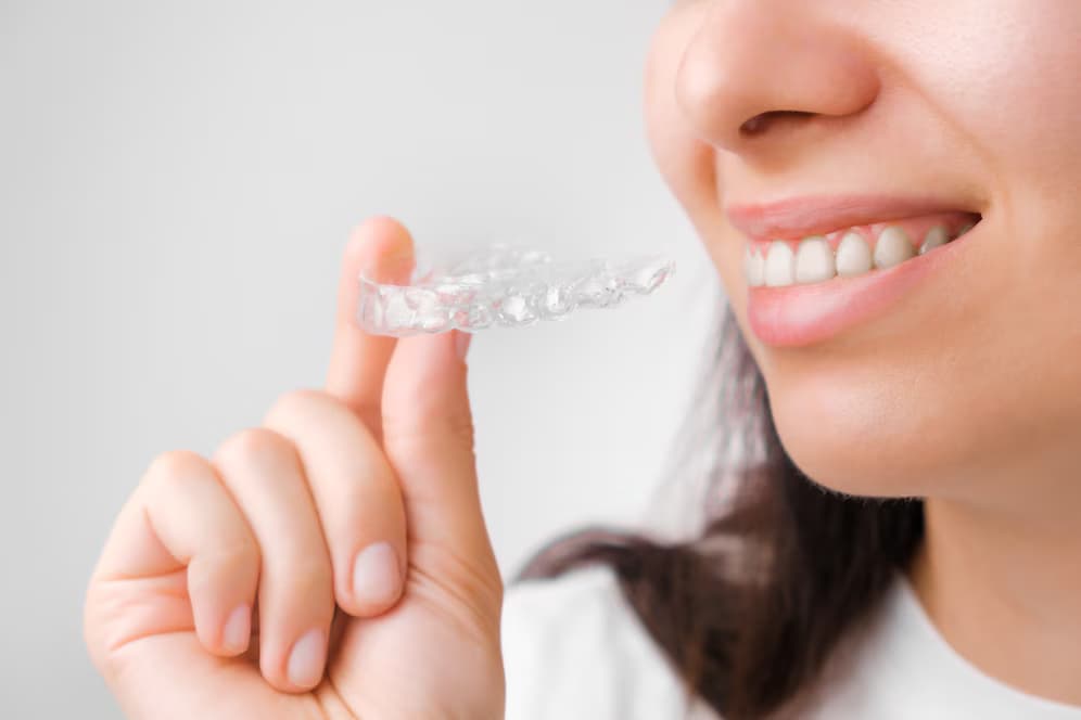 Clear Aligners