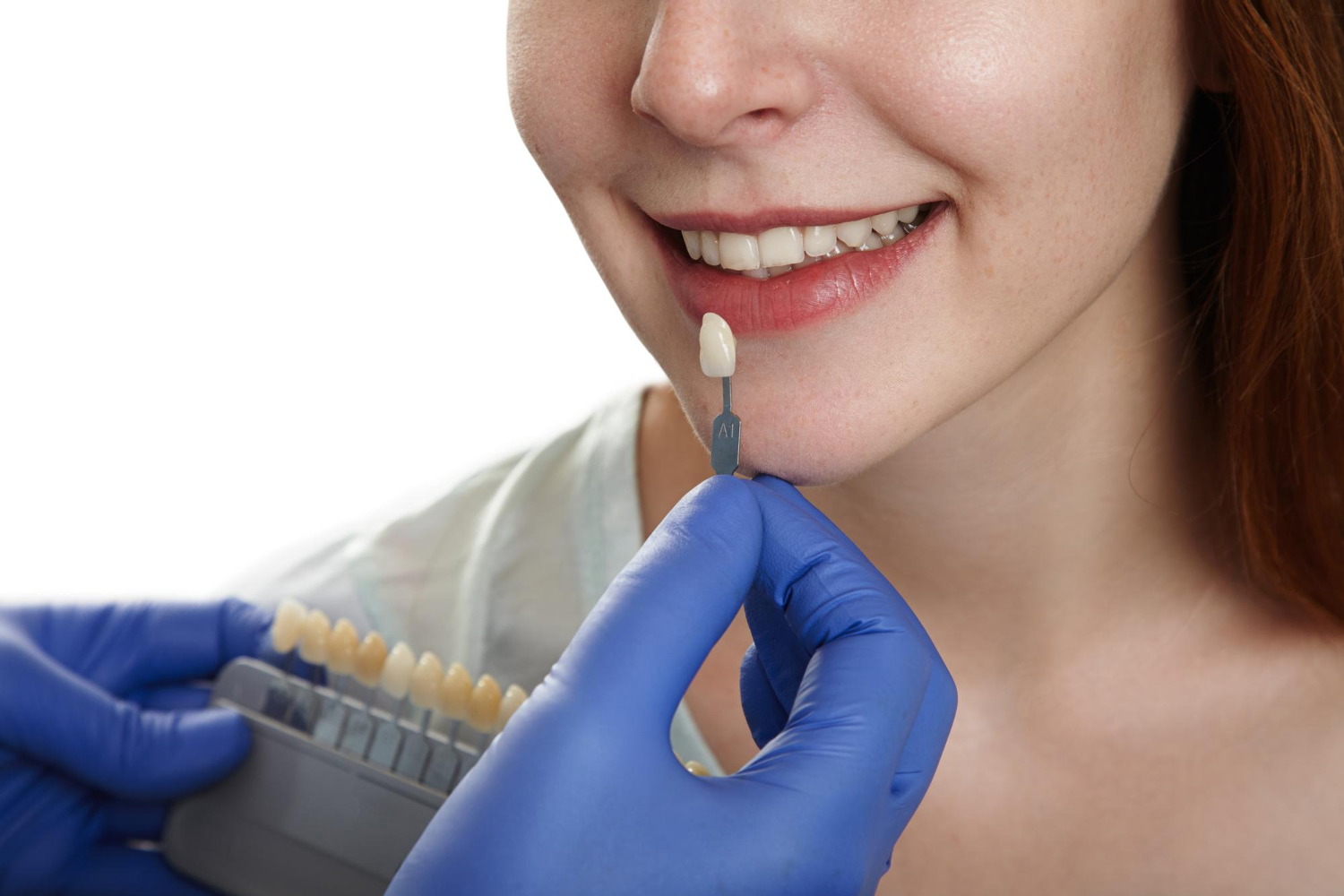 Dental Veneers in Somerville
